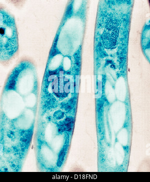 Micrographe de bactéries Bacillus anthracis Banque D'Images