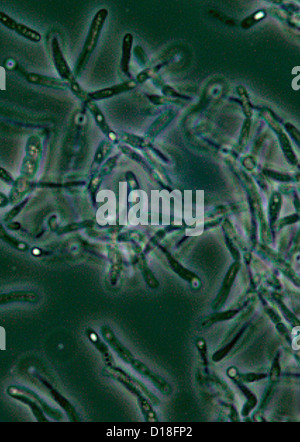 Photomicrographie de spores de Bacillus anthracis Banque D'Images