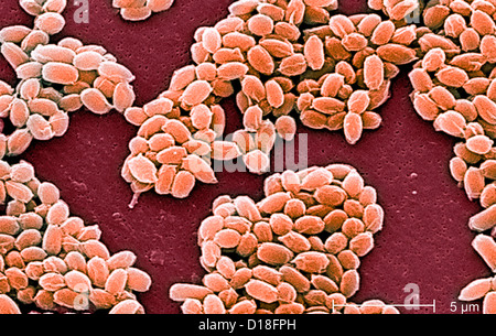 Micrographe de spores de charbon Banque D'Images