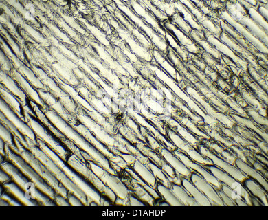 L'oignon sous le microscope, l'arrière-plan. (Allium cepa) Banque D'Images