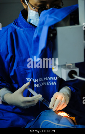 Un patient subissant une chirurgie de la cataracte dans une clinique mobile, Bali, Indonésie. Banque D'Images