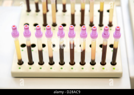 Essen, Allemagne, la mesure de la vitesse de sédimentation des érythrocytes dans un laboratoire de cytologie Banque D'Images