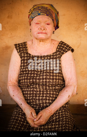 Portrait de femme africaine âgées albino. Banque D'Images