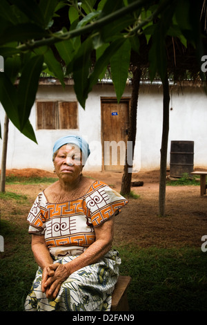 Portrait de femme albinos âgées devant sa maison. Banque D'Images