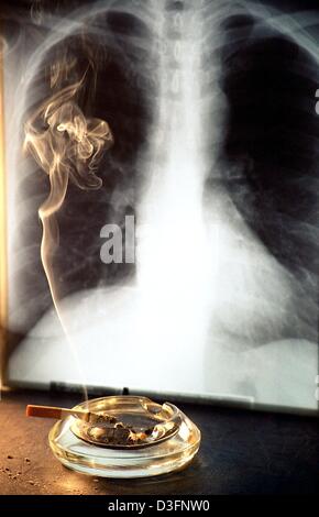 (Afp) - Un cendrier de mégots est symboliquement placé devant la radiographie pulmonaire à Berlin, Allemagne, 10 mai 2003. Selon les médecins allemands du cancer du poumon est possible au résultat à long terme d'une consommation excessive de tabac. Tous les jours 340 fumeurs meurent de leur toxicomanie, en ajoutant jusqu'à 140 000 par an. Banque D'Images