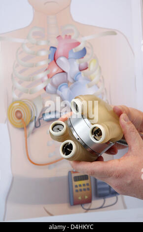 Vue sur le cœur artificiel totalement implantable ?ReinHeart ? Au Cœur et le diabète Centre à Bad Oeynhausen, Allemagne, 23 janvier 2009. Les scientifiques ont testé avec succès le nouveau coeur artificiel en expérimentation animale, il a été implanté à un veau, le 21 janvier et a travaillé pendant plus d'une heure stable avant de s'arrêter. Photo : FRISO GENTSCH Banque D'Images