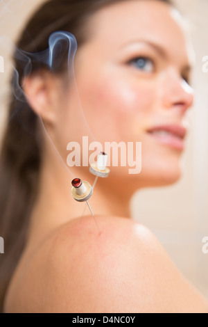 La moxibustion aiguilles acupunture sur l'épaule de chaleur femme gros plan Banque D'Images