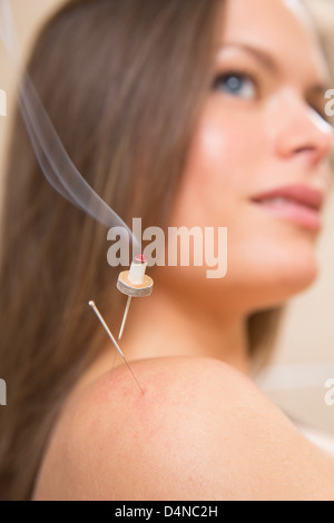 La moxibustion aiguilles acupunture sur l'épaule de chaleur femme gros plan Banque D'Images