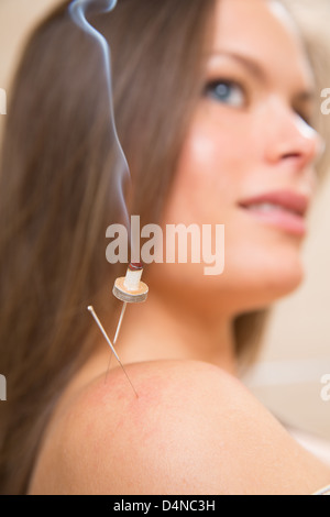 La moxibustion aiguilles acupunture sur l'épaule de chaleur femme gros plan Banque D'Images