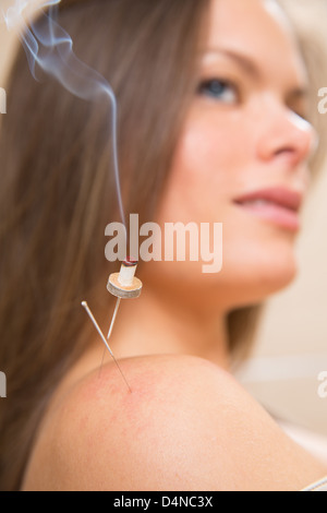 La moxibustion aiguilles acupunture sur l'épaule de chaleur femme gros plan Banque D'Images