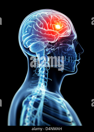 Maux de tête Banque D'Images