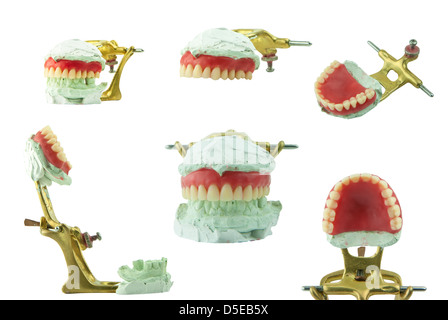 La cire dentaire jeu de mâchoires avec modèle Banque D'Images