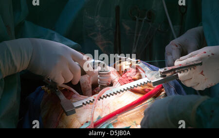 Chirurgien cardiaque Ivan Netuka met une nouvelle pompe sanguine mécanique dans la poitrine du patient à l'Institut de médecine clinique et expérimentale (IKEM) à Prague, République tchèque, le 3 avril 2013. IKEM fête ses dix ans à l'aide de cette méthode. (Photo/CTK Michal Dolezal) Banque D'Images