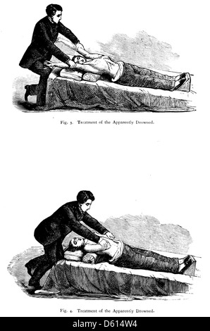Ce guide de 1878, « Une Cyclopædia domestique d'informations pratiques », fournit des instructions sur le traitement d'urgence en cas de noyade. Le livre vise à offrir des conseils pratiques sur les urgences domestiques et médicales pour le lecteur du XIXe siècle. Banque D'Images