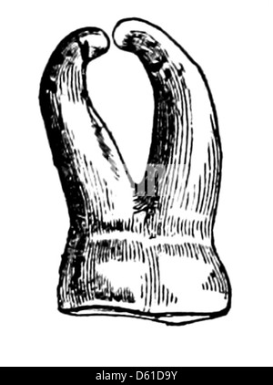 Cette image de 1868 présente un manuel sur l'extraction dentaire, présentant les méthodes utilisées au XIXe siècle pour enlever les dents molaires. Le manuel reflète les pratiques médicales de l'époque, détaillant les outils et les procédures utilisés par les dentistes à l'époque. Banque D'Images