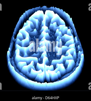 Brain Scan, IRM, heightmap Banque D'Images