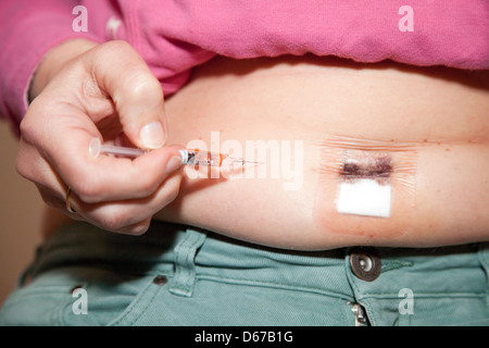 Femme de l'auto-injection d'héparine anticoagulant pour prévenir la thrombose post-opératoire ( DVT ), UK Banque D'Images