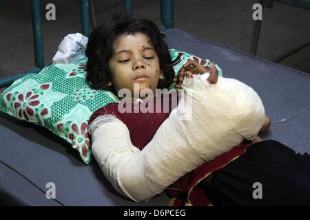 Dhaka, Bangladesh. 22 avril, 2013. Tania dans l'unité de soins aux brûlés de Dhaka Medical College Hospital après-savoir manipuler une bombe faite maison son frère ramassé dans la rue et apporté à la maison. Les médecins disent qu'elle pourrait perdre trois doigts de sa main droite. Banque D'Images