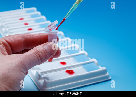 L'application de préparation biologique sur la diapositive Banque D'Images