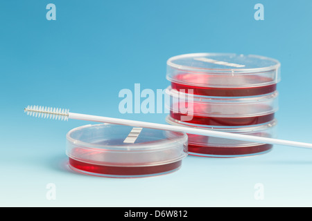 Culture des cultures pathogènes dans des boîtes de Petri Banque D'Images