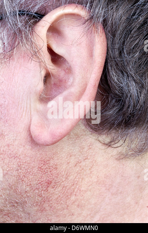 L'oreille poilue gros plan homme des personnes âgées. Les cheveux gris, la peau est couverte de pores et les vaisseaux sanguins. Selective focus Banque D'Images