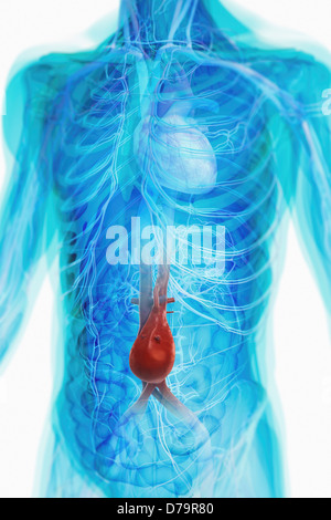 L'anévrisme de l'aorte Banque D'Images