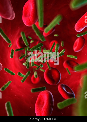 L'infection bactérienne, artwork Banque D'Images