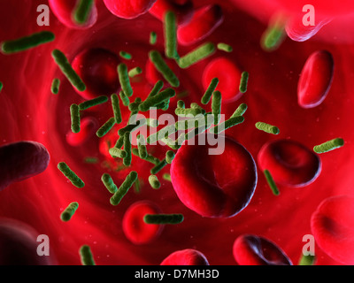 L'infection bactérienne, artwork Banque D'Images