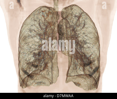 La santé des poumons, scanner 3D Banque D'Images
