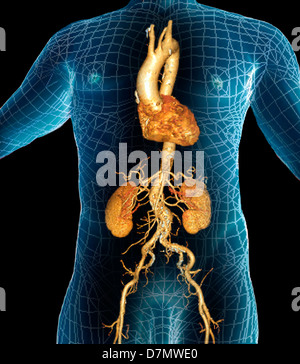 L'aorte, scanner 3D Banque D'Images