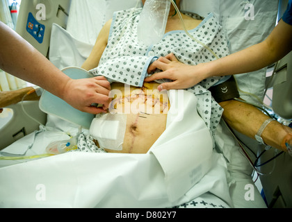 Le personnel médical s'occuper d'un patient qui a fait des points de suture dans la région abdominale après l'opération, sur une unité de soins intensifs. Banque D'Images