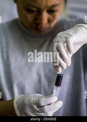 21 mai 2013 - Mae Ku, Tak, Thaïlande - un travailleur en soins de santé birman travaille avec le sang d'un patient sur le paludisme Mawker SMRU thaïlandais dans la clinique Mae Ku, la Thaïlande. Les professionnels de la santé voient de plus en plus de preuve du paludisme résistant à l'artémisinine qui sortent de la jungle d'Asie du sud-est. L'artémisinine a été le premier choix pour la lutte contre le paludisme en Asie du sud-est de 20 ans. Depuis quelques années pourtant, les travailleurs de la santé au Cambodge et au Myanmar (Birmanie) voient des signes que le parasite du paludisme est devenu résistant à l'artémisinine. Les scientifiques qui étudient le paludisme sont concernés que l'histoire co Banque D'Images