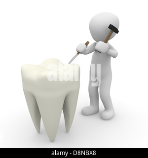 Un dentiste réparé les très grandes dents avec un marteau. Banque D'Images