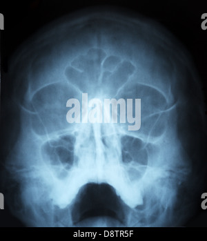 La radiographie de crâne humain vue avant Banque D'Images