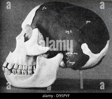 Modèle de crâne de l'homme de Piltdown (Eanothropus dawsoni) comme reconstruit par le Dr Smith Woodward. Les zones sombres sont du fossile original, la lumière sont les zones restaurées. La plupart de la mâchoire inférieure restaurée sur le côté éloigné. À partir de 'Scientific American' 7 Novembre 1914. Banque D'Images