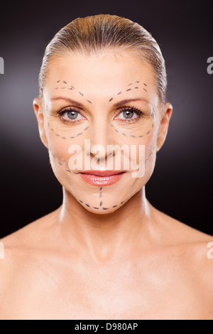 Portrait of senior woman avant la chirurgie plastique close up Banque D'Images