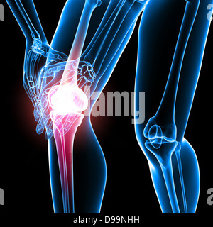 Les droits de l'anatomie la douleur au genou Banque D'Images