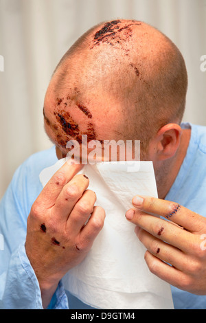 44 ans, homme, et à l'hôpital avec fracture du crâne. Banque D'Images