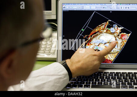 Dr. Hans Gerd Kehl, l'commissionary chef de la cardiologie, de l'enfant points à un écran avec un dessin animé coeur modèle à l'aire de la cardiologie de l'Hôpital universitaire de Münster, Allemagne, 10 décembre 2010. La jeune fille est née avec une coarctation de l'aorte. Chaque année, 6000 enfants atteints de malformations cardiaques sont nés en Allemagne. Les chances de survie pour les jeunes patients ha Banque D'Images