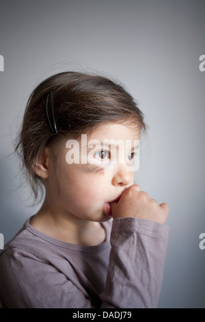 Girl with black eye sucking thumb Banque D'Images