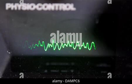 Le graphe d'un défibrillateur cardiaque indique que la fibrillation ventriculaire dans la soi-disant skillslab à l'enseignement Ministère de l'hôpital universitaire de Halle, en Allemagne, 7 juin 2011. Les étudiants en médecine en trains skillslab séances hebdomadaires comment configurer une injection, un cathéter, une infusion, comment lire des ECG et de préparer les injections et réanimer les gens. Photo : Jan Woitas Banque D'Images