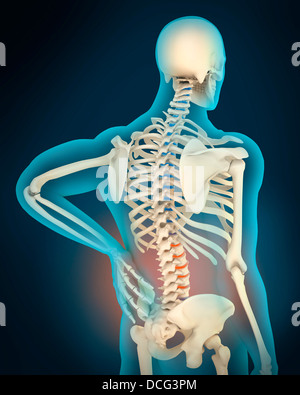 Illustration médicale montrant l'inflammation et la douleur dans la zone arrière, vue en perspective. Banque D'Images