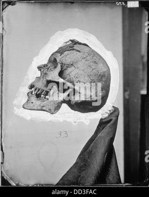 Une image détaillée d'un crâne, montrée du côté gauche, offrant une vue claire de sa structure. L'image est utilisée à des fins éducatives dans le cadre d'études anatomiques ou médico-légales, en se concentrant sur la structure osseuse. Banque D'Images