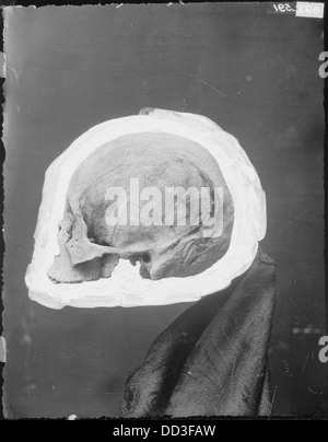 Cette image montre une vue du côté gauche d'un crâne humain, offrant un aperçu de sa structure. La photographie met en évidence l'anatomie détaillée, y compris les caractéristiques clés telles que les cavités oculaires et la ligne de mâchoire. Banque D'Images