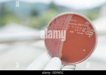 Allemagne, Fribourg, Human Hand holding petri dish avec les bactéries, Close up Banque D'Images