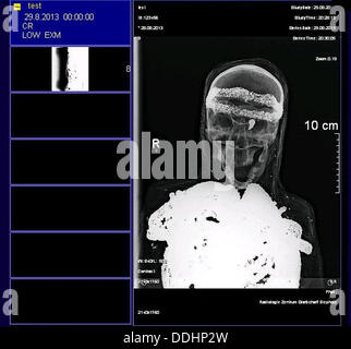 Document - Un document sans date photo d'un x-ray photo datée du 29 août 2013 présente le crâne d'une momie avec bandeau et triangle. La momie a été trouvé au début du mois d'août 2013 dans un grenier à Diepholz et contient un crâne humain. Photo : Wolfgang Lutz ( Kettler - CRÉDIT OBLIGATOIRE : : Wolfgang Lutz) KETTLER (meilleure qualité) Banque D'Images