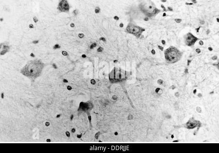 Médecine, anatomie, cerebrac / cranium, cellules nerveuses du tronc cérébral humain, Pons, photo du Dr Adelheid Winkelmann, 20e siècle, 20e siècle, microscopie, neurale, neuritique, voie nerveuse, voie nerveuse, voies nerveuses, voies nerveuses, voies nerveuses, tronc cérébral, pons, médecine, médicaments, cellule nerveuse, cellules nerveuses, historique, historique, historique, autres-droits-Clearences-non disponible Banque D'Images