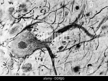 Médecine, anatomie, cerebrac / cranium, cellule nerveuse du cervelet humain, 20e siècle, microscopie, cellule nerveuse, cellules nerveuses, neurale, néritique, voie nerveuse, tractus nerveux, voies nerveuses, voies nerveuses, voies nerveuses, cervelet, médecine, médicaments, historique, historique, historique, droits additionnels-Clearences-non disponible Banque D'Images