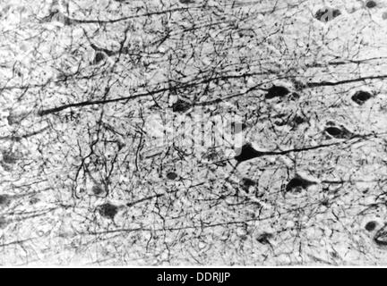 Médecine, anatomie, cerebrac / cranium, cortex du cerebrum humain, cellules pyramidales, photo du Dr Adelheid Winkelmann, 20e siècle, 20e siècle, microscopie, cellule nerveuse, cellules nerveuses, neurales, néritiques, voie nerveuse, tractus nerveux, voies nerveuses, voies nerveuses, voies nerveuses, voies nerveuses, voies cérébrales, cerebrum, cellules pyramidales, médecine, cortex, médicaments historiques, Clearences-non disponibles Banque D'Images