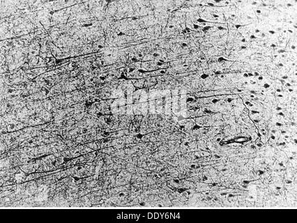 Médecine, anatomie, cerebrac / cranium, cortex du cerebrum humain, cellules pyramidales, photo du Dr Adelheid Winkelmann, 20e siècle, 20e siècle, microscopie, cellule nerveuse, cellules nerveuses, neurales, néritiques, voie nerveuse, tractus nerveux, voies nerveuses, voies nerveuses, voies nerveuses, voies nerveuses, voies cérébrales, cerebrum, cellules pyramidales, médecine, cortex, médicaments historiques, Clearences-non disponibles Banque D'Images